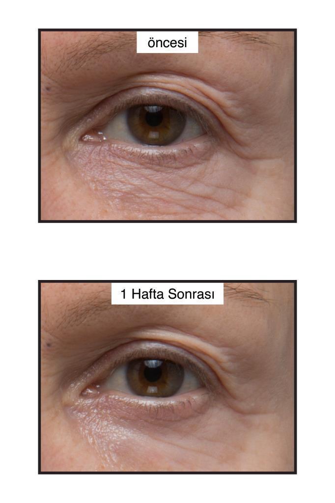 Murad Age Reform Rapid Collagen Infusion Collagen Serum - Anti-aging Hydrating Serum for All Skin Types