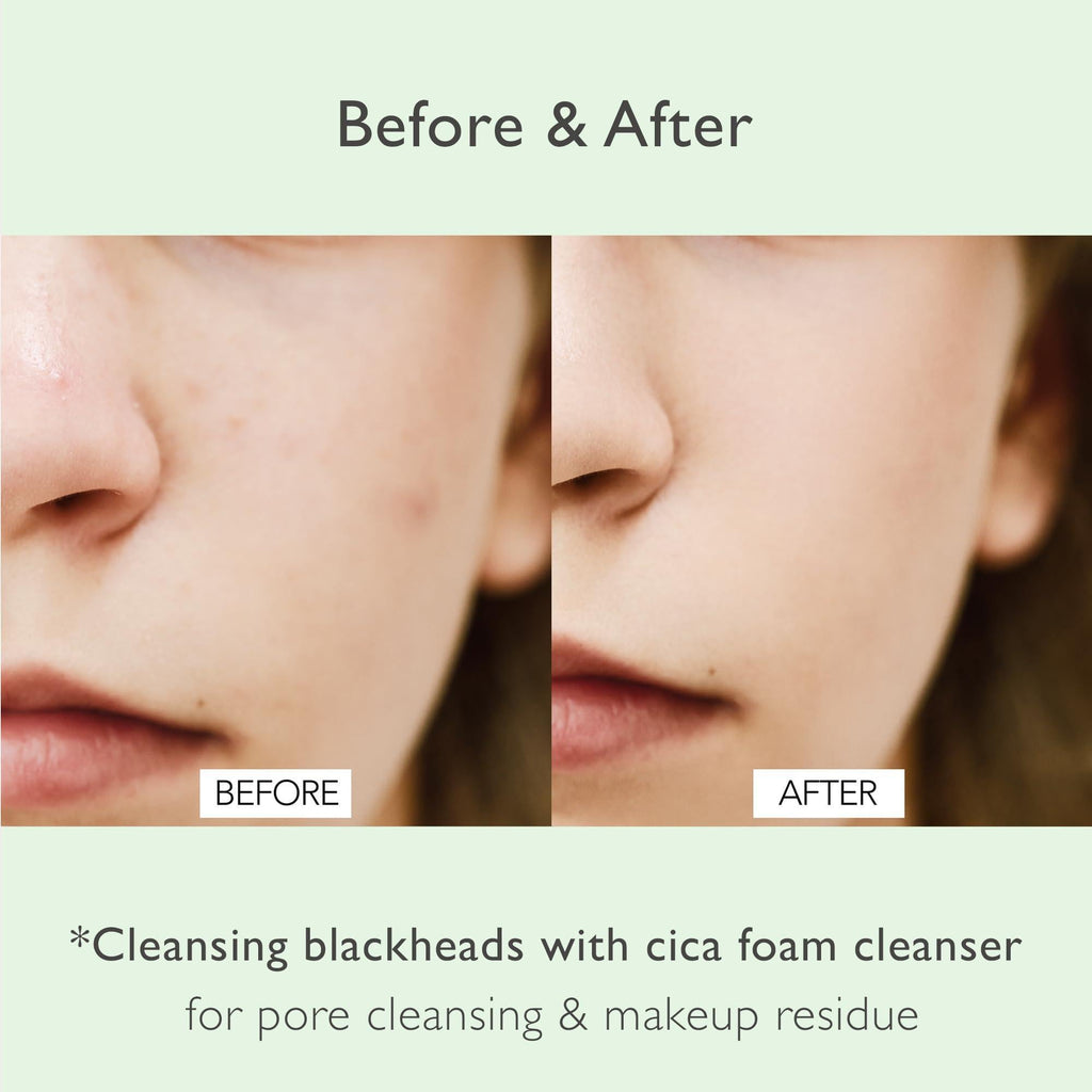 Cica Pore Cleansing Foam 4.05 fl oz Sebum Control Hyaluronic Acid Aloe Daily