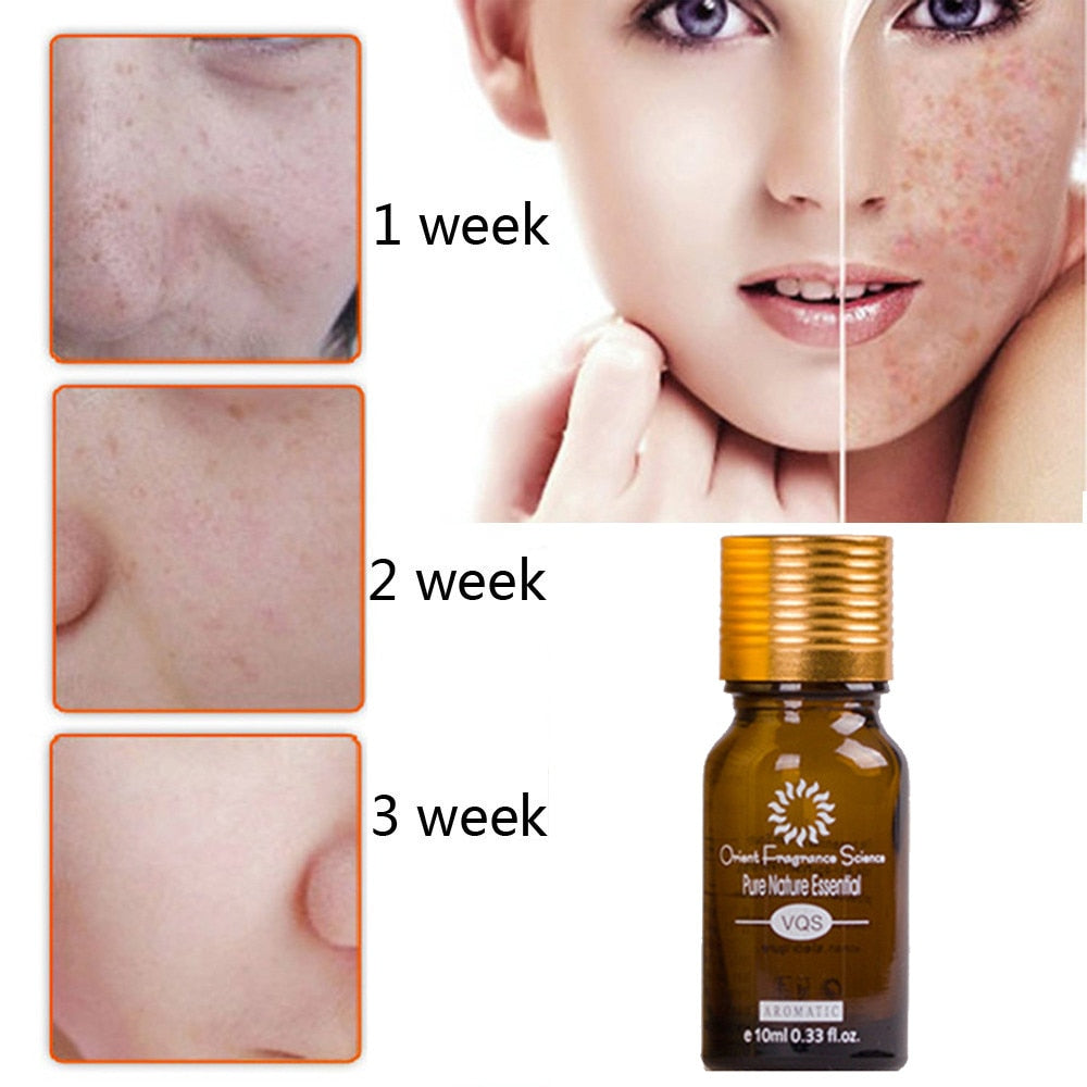 Dredge Meridian Skin Care Natural Pure Removal Acne Stretch Marks Scar Remova