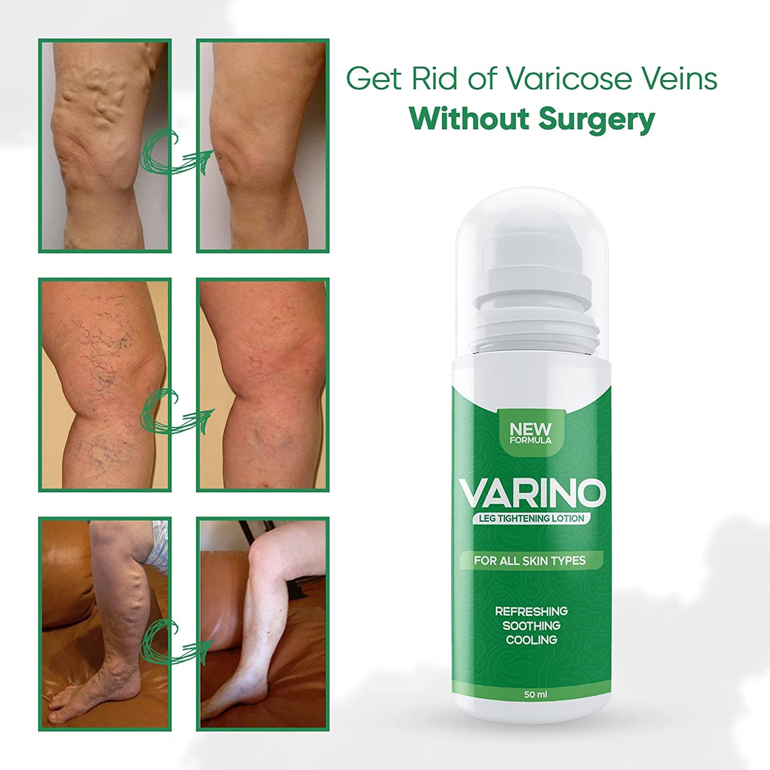 Varino Leg Tightening Lotion, Circulation and Vein Support for Healthy Legs