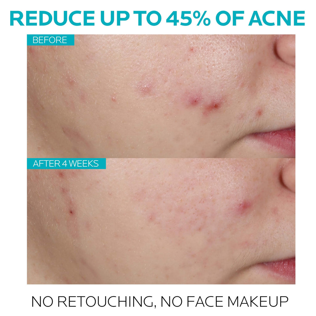 La Roche Posay Effaclar Ultra Concentrated Serum 30ml