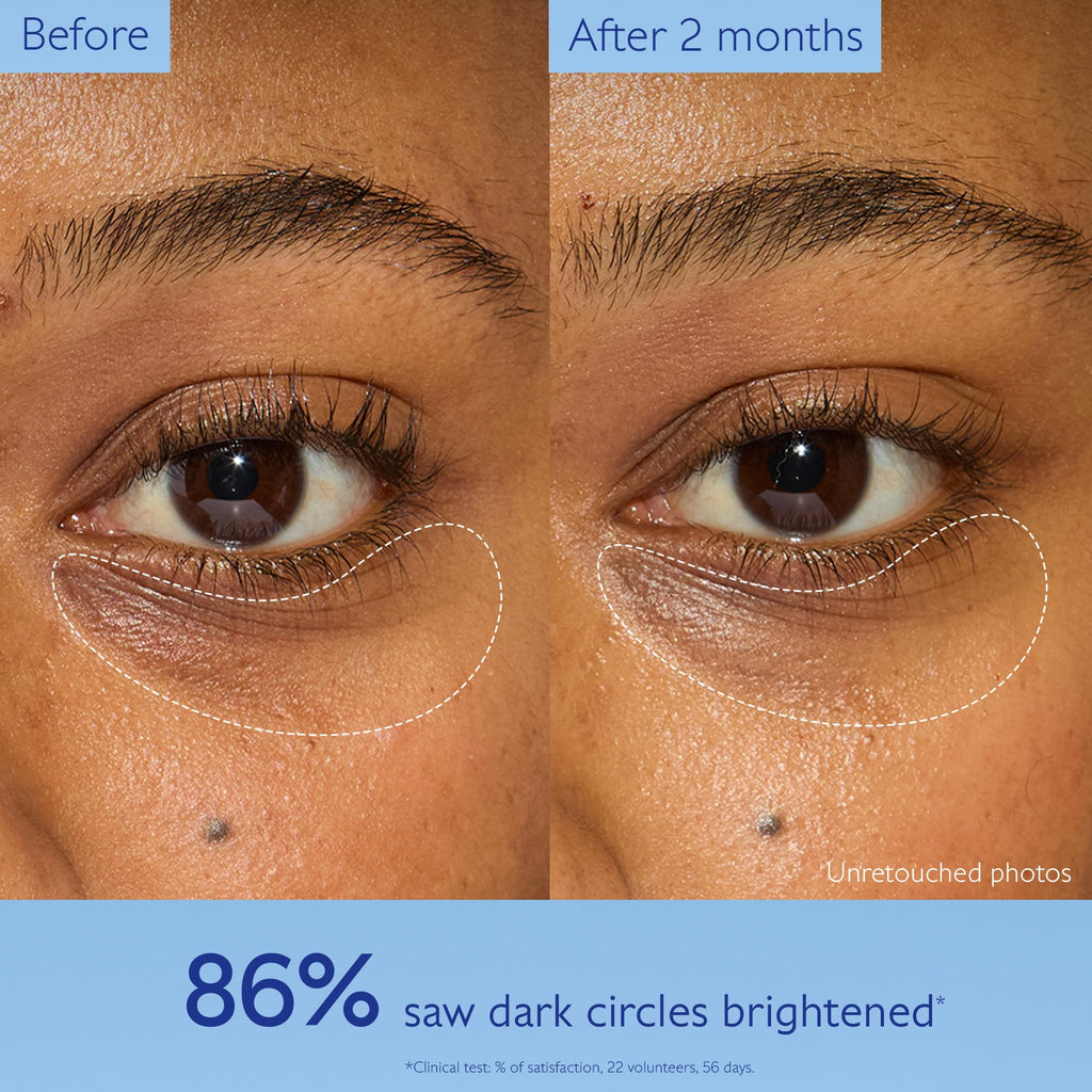 Caudalie Vinoperfect Brightening Eye Cream - Dark Circle Treatment & Anti-aging Eye Care