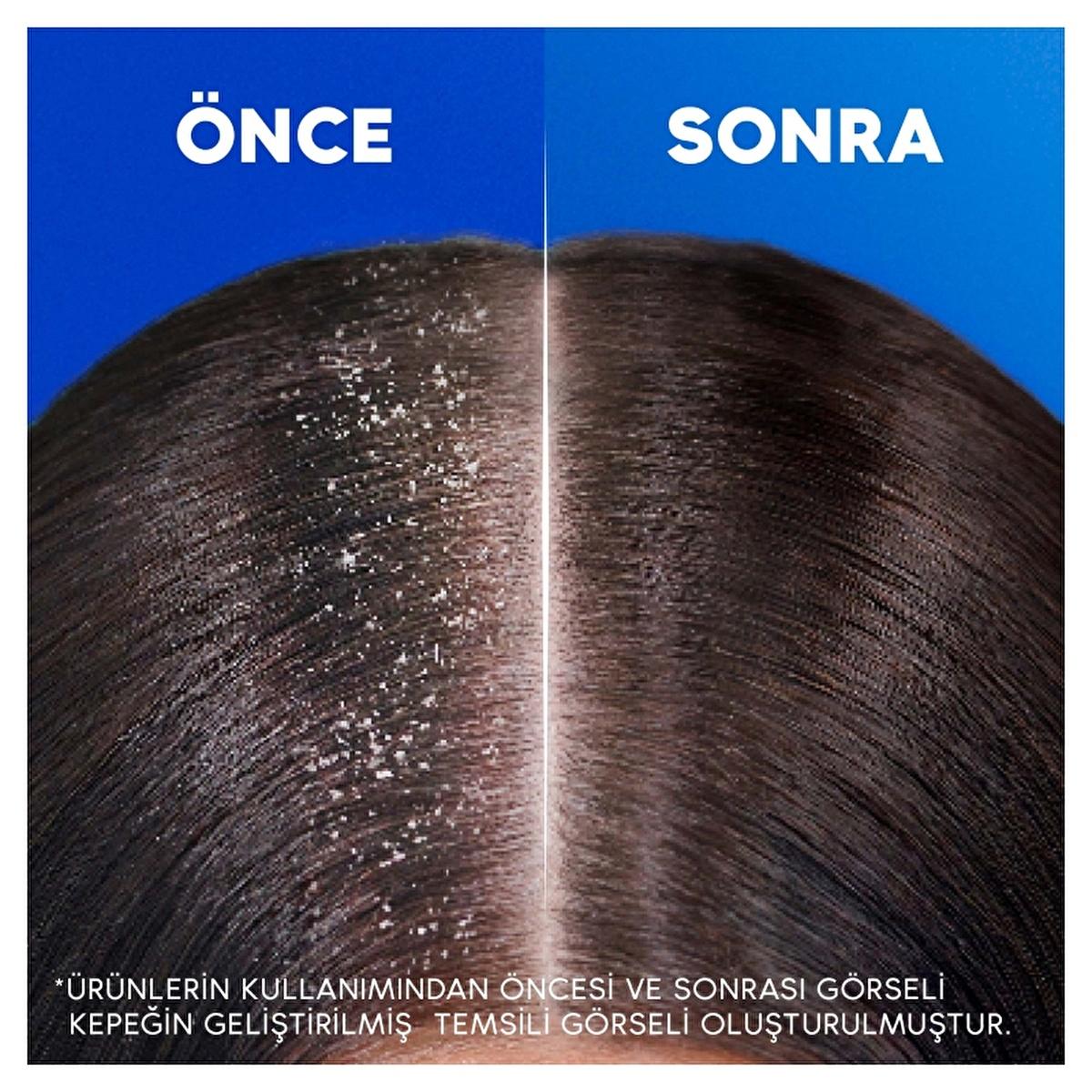 Head & Shoulders Anti-Dandruff Shampoo, Nourishing & Dermatologically Tested, 11.16 fl oz