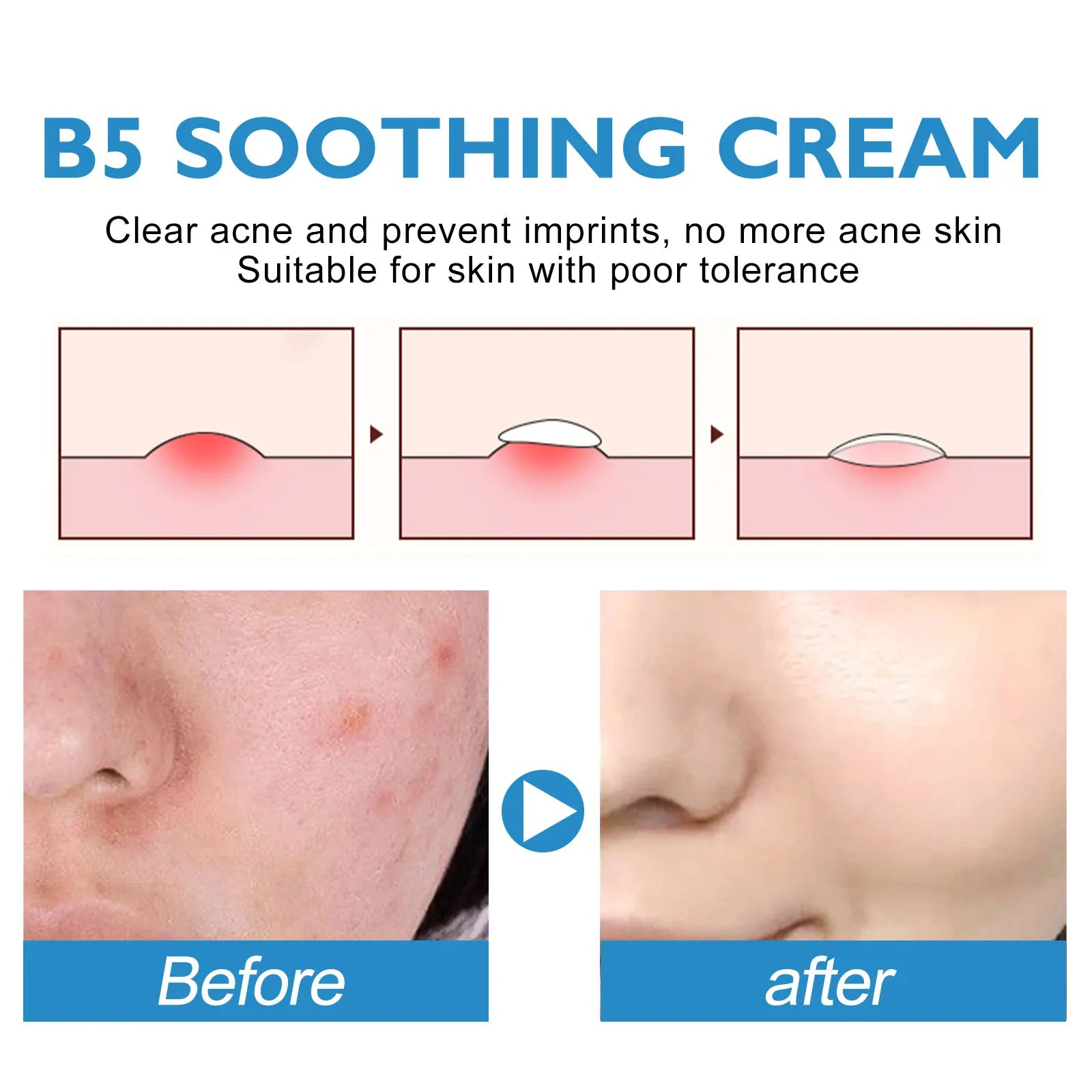 B5 Repair Cream Moisturizing Hydrating Soothing Dry Chapped Redness Skin Nourishes Hydrating Barrier Support Beauty Face Cream