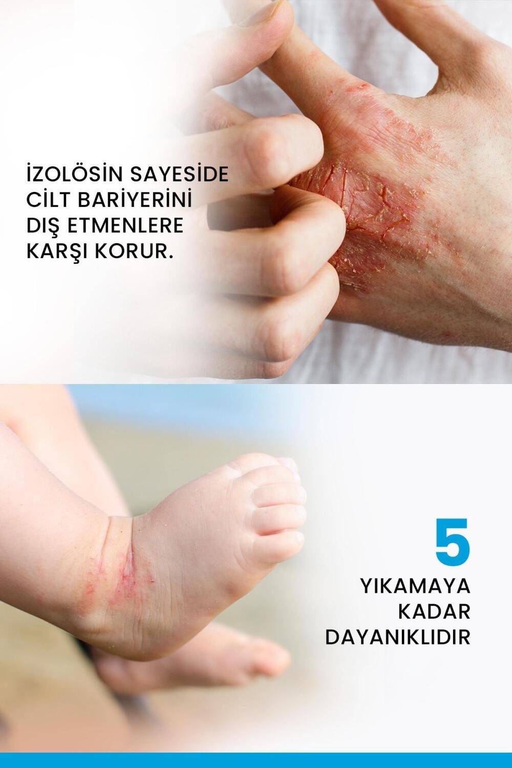Ducray Dexyane: Barrier Cream for Dry, Atopic Skin - Strengthen, Soothe & Protect | Moisturizing Cream for Dermatitis