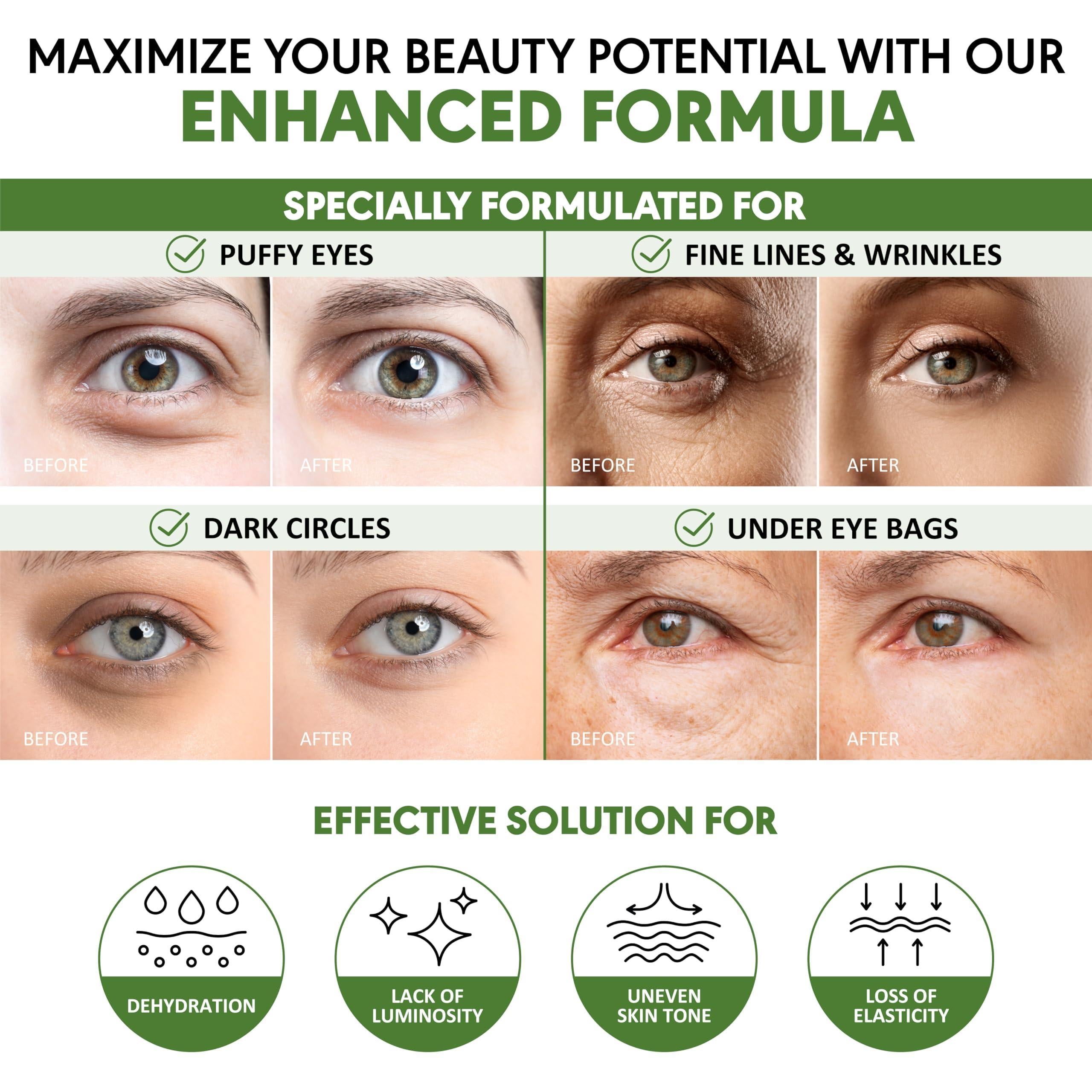 Green Tea Under Eye Patches for Wrinkles and Eye Bags 30 Pairs Eye Masks for