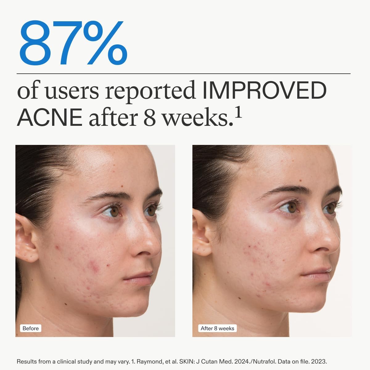 Nutrafol Clear Skin Nutraceutical Acne Supplement 3-Month Supply